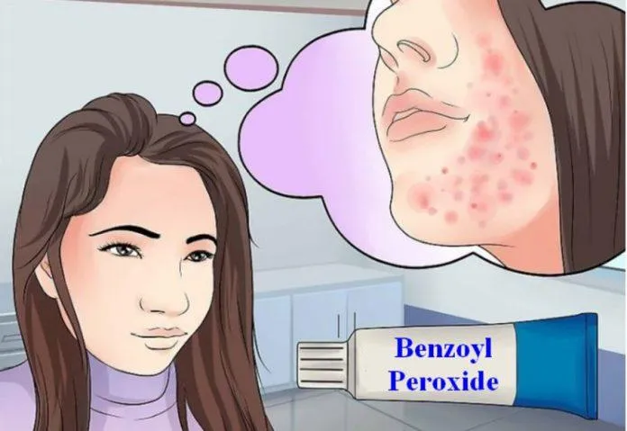 Benzoyl Peroxide có tác dụng gì? TOP 10 sản phẩm Benzoyl Peroxide trị mụn sưng viêm tốt nhất hiện nay