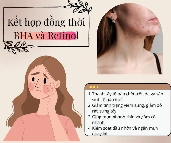 BHA và Retinol chinh là bộ đôi hoàn hảo giúp da khắc phục được nhiều vấn đề từ loại bỏ da chết, tăng sinh tế bào mới cho đến giảm sưng viêm (nguồn: Blogphunu.edu.vn)