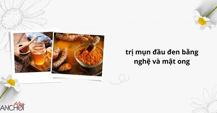 Nghệ và mật ong vẫn luôn được tin dùng trong việc dưỡng sáng da và trị mụn đầu đen đấy nhá ( Nguồn: Blogphunu.edu.vn)