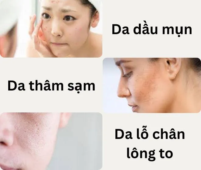 Các đối tượng nên sử dụng kết hợp BHA và Niacinamide. (Nguồn ảnh: Blogphunu.edu.vn)