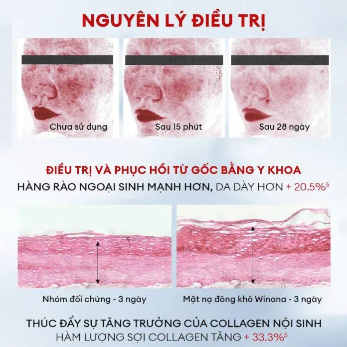 Mặt nạ đông khô trẻ hóa da Winona có thần thánh như lời đồn?