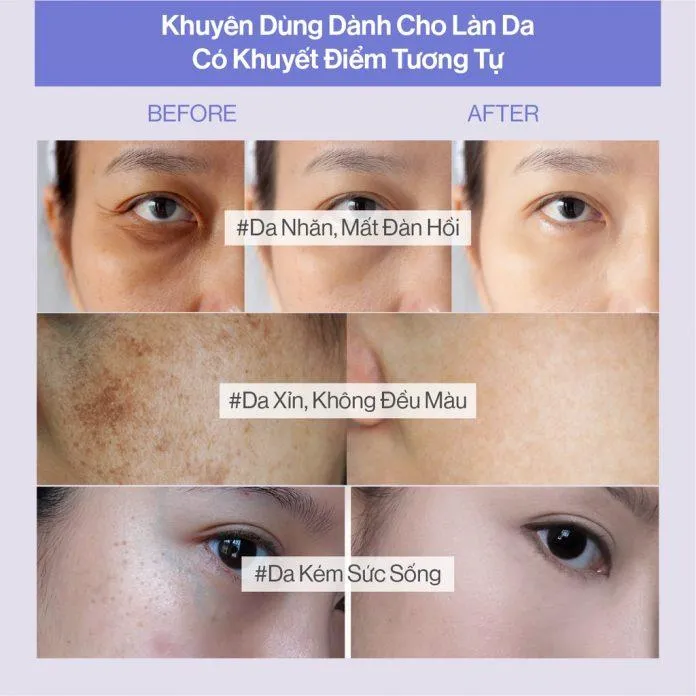 Sau khi dùng bột uống collagen Gilaa Premium Saffron Collagen da được cải thiện tích cực hơn rất nhiều (nguồn: internet)