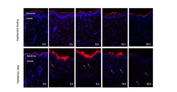 Hình soi da từ kính hiển vi đồng tiêu cấp tế bào thể hiện sự khác biệt về độ thẩm thấu giữa peptide bình thường và peptide bọc vàng.