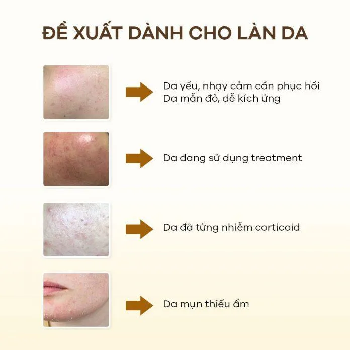 Sản phẩm đặc biệt dành cho da đang treatment.