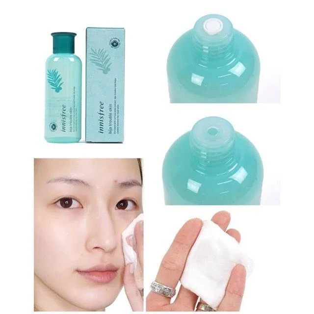 Sử dụng toner Innisfree Bija Trouble Skin giúp làn da sạch thoáng, kiềm dầu, giảm mụn, ẩm mượt, căng mịn (ảnh: internet).