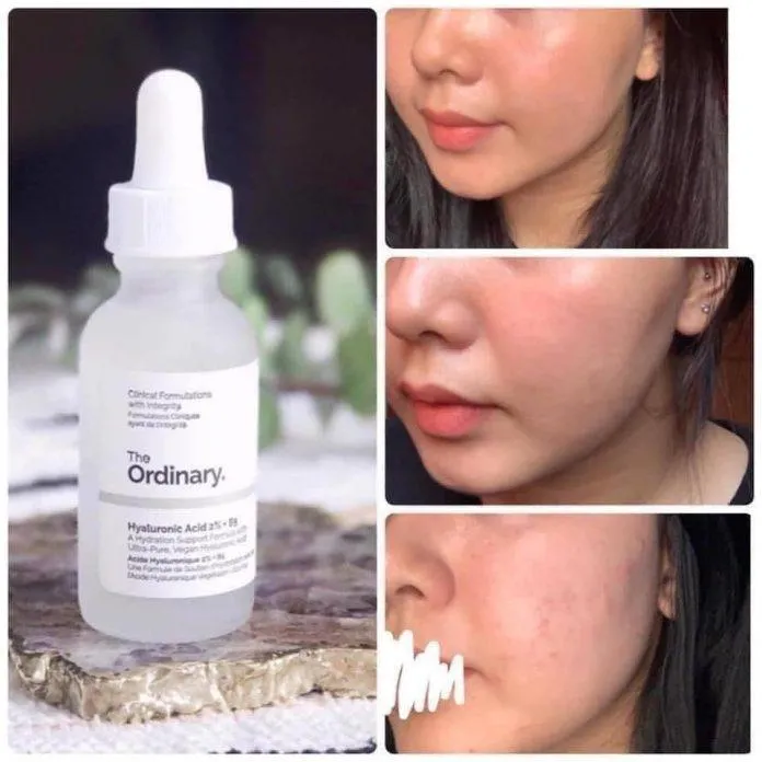 Review The Ordinary Hyaluronic Acid 2% + B5 Serum của khách hàng đã sử dụng trên Facebook. (NguoofnL Blogphunu.edu.vn)