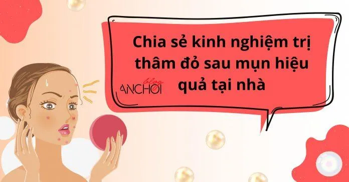 Thâm đỏ sau mụn là gì ? Chia sẻ kinh nghiệm trị thâm đỏ đúng cách