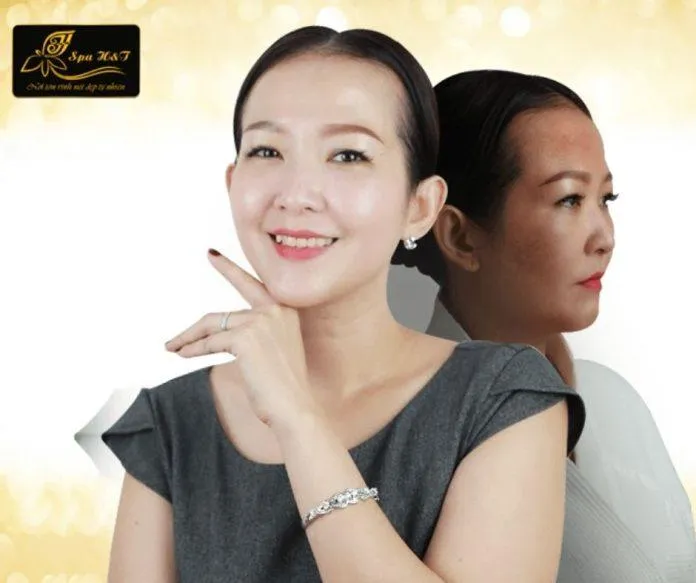 Công nghệ trị nám Hoàng gia của H&T Beauty không áp dụng laser thông thường (Nguồn: H&T Beauty)