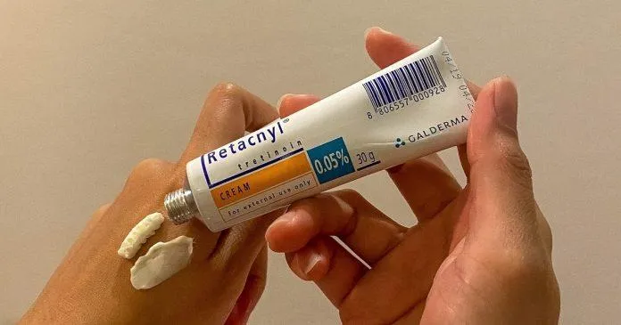 Sản phẩm Retacnyl Cream Tretinoin 0.05% (Nguồn: Internet).